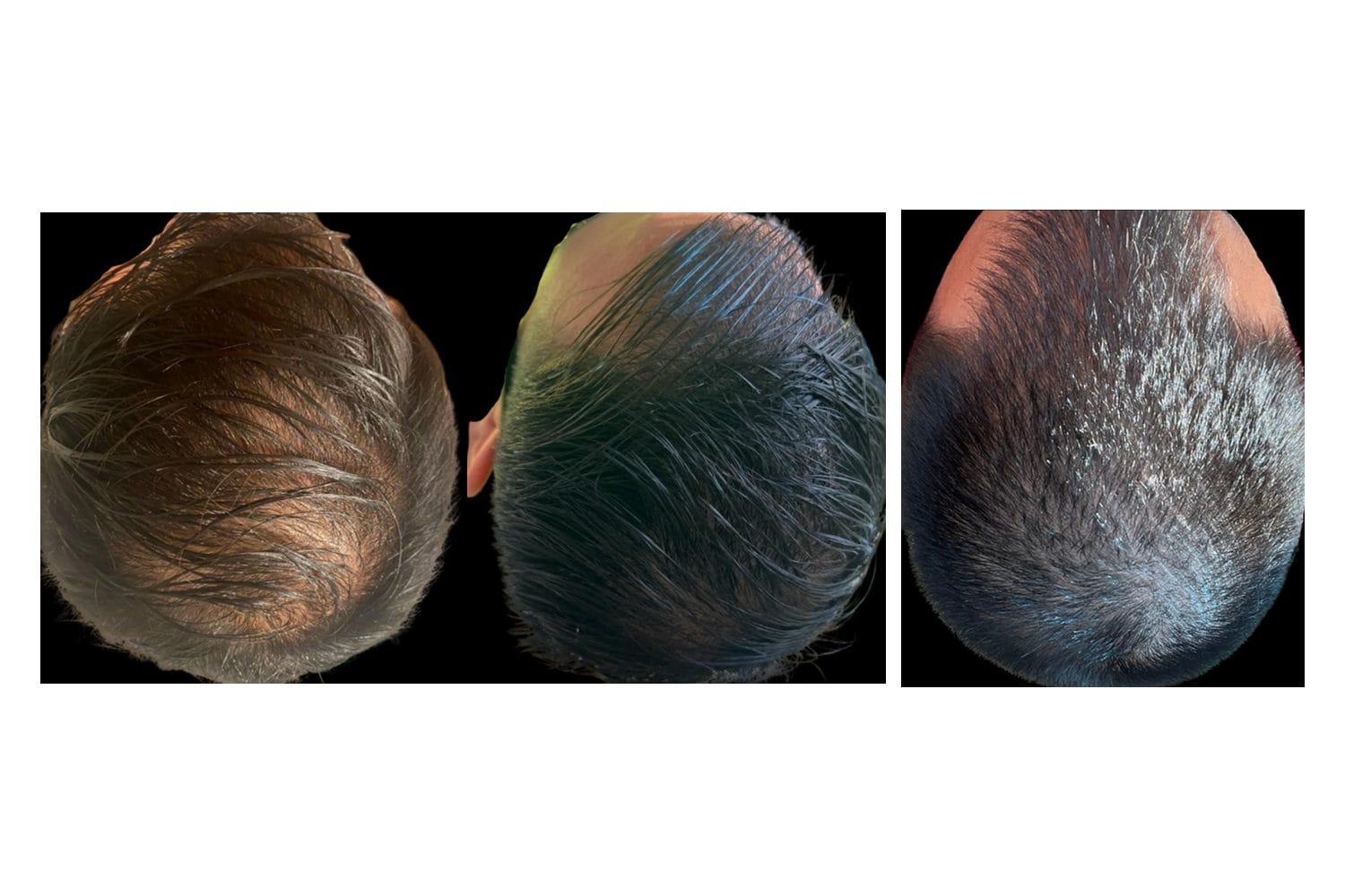 AquaFirmeXS & DE|RIVE before and after &middot; Scalp / hair