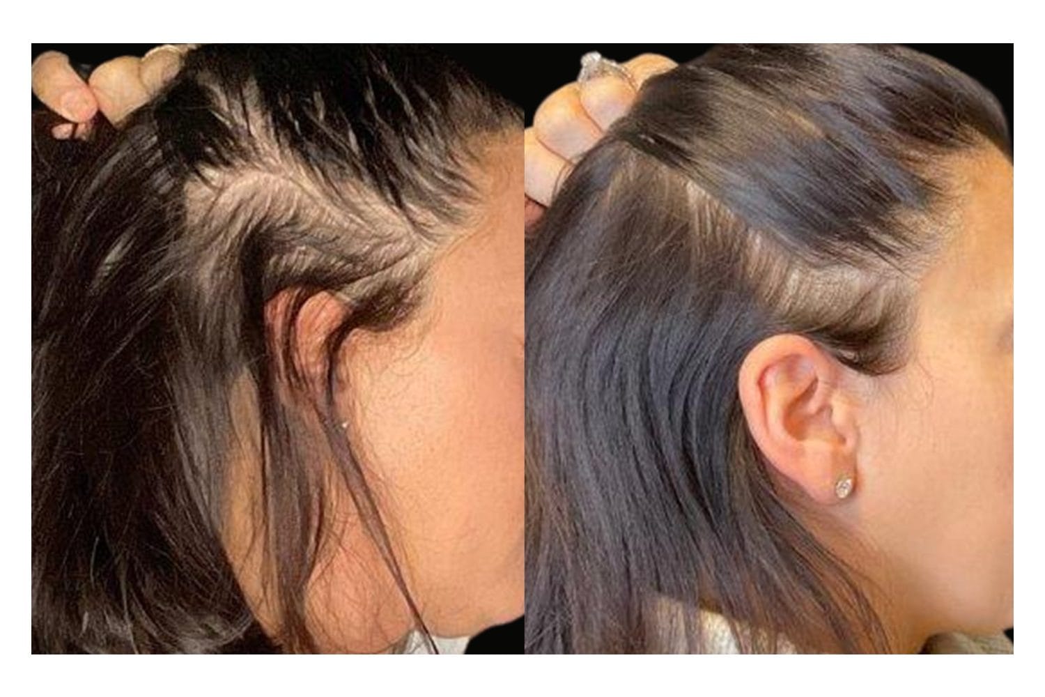 AquaFirmeXS & DE|RIVE before and after &middot; Scalp / hair