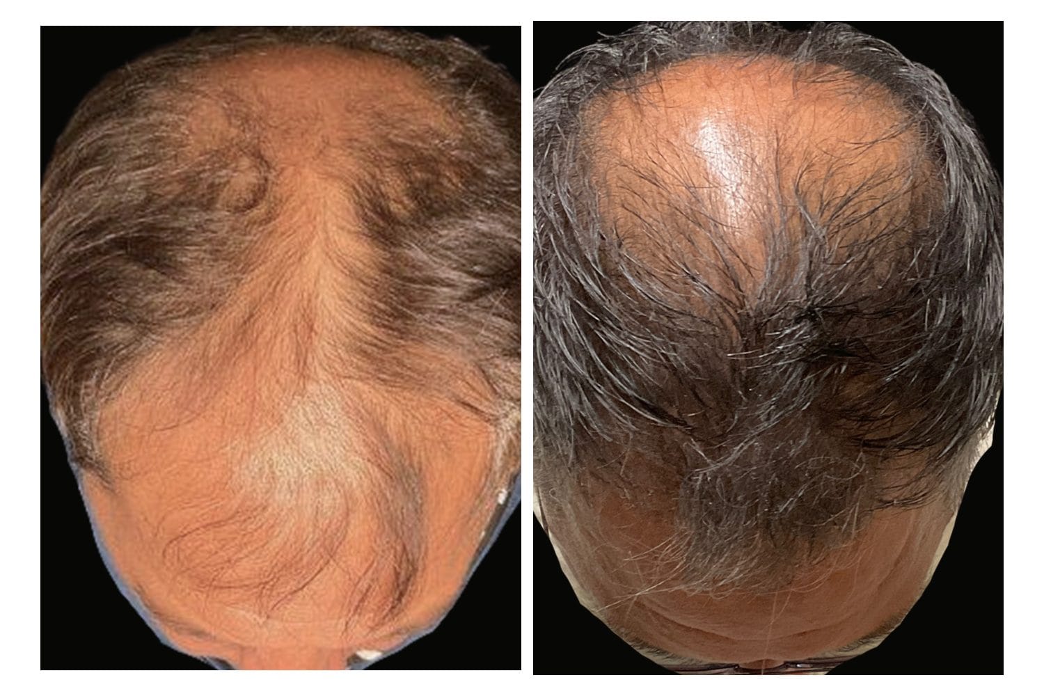 AquaFirmeXS & DE|RIVE before and after &middot; Scalp / hair