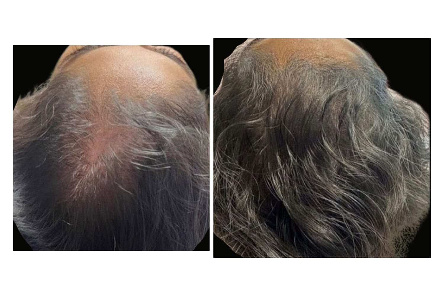 AquaFirmeXS & DE|RIVE before and after &middot; Scalp / hair