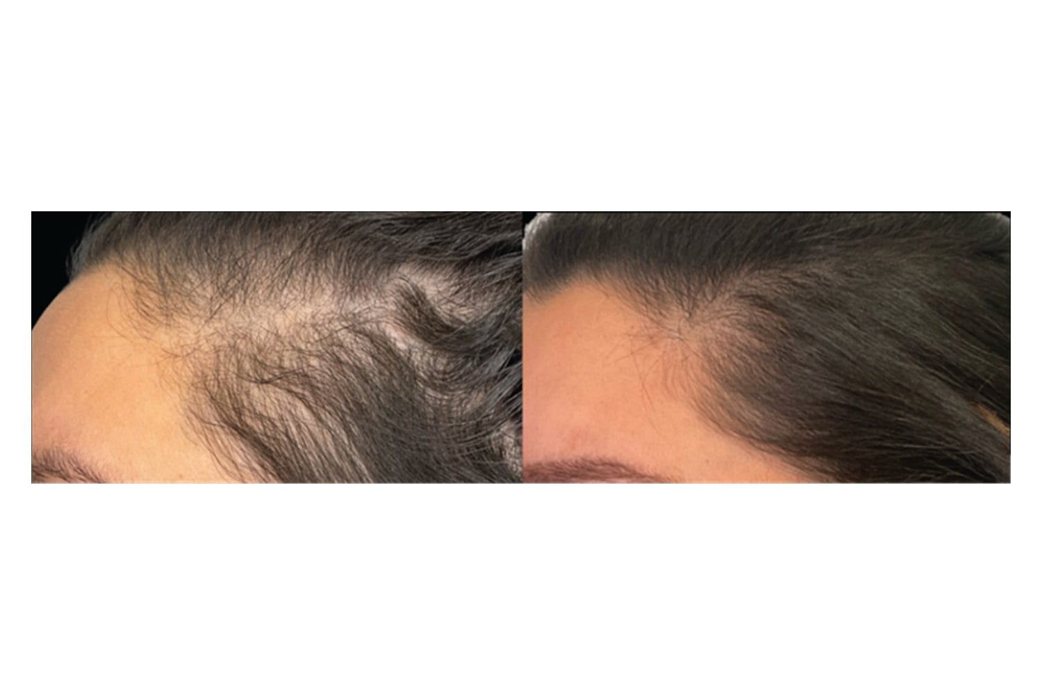 AquaFirmeXS & DE|RIVE before and after &middot; Scalp / hair