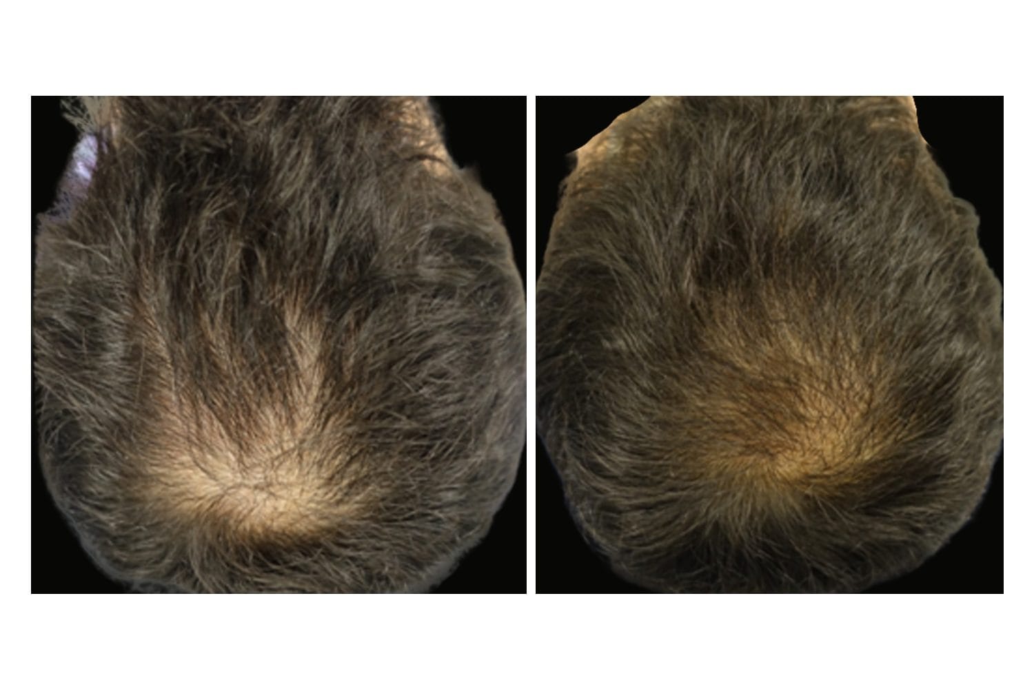 AquaFirmeXS & DE|RIVE before and after &middot; Scalp / hair