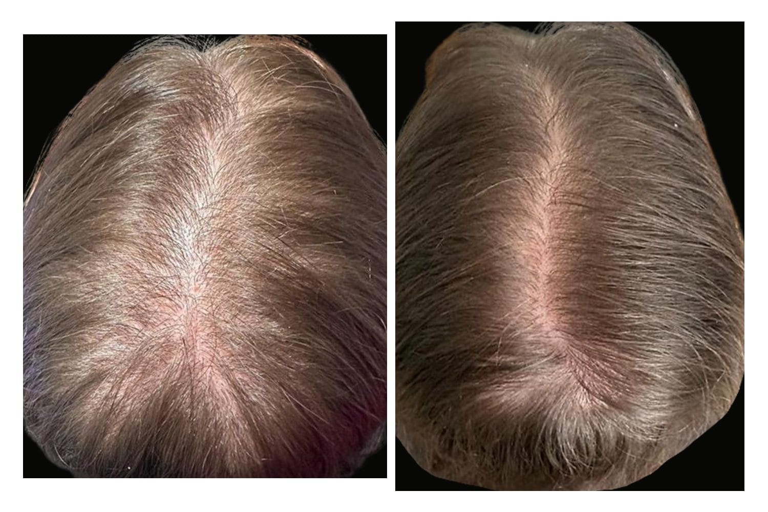 AquaFirmeXS & DE|RIVE before and after &middot; Scalp / hair