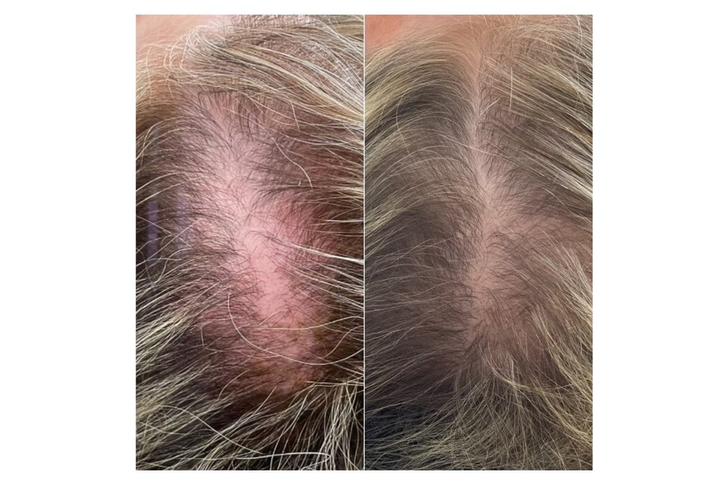 AquaFirmeXS & DE|RIVE before and after &middot; Scalp / hair
